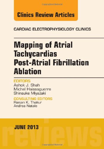 Mapping of Atrial Tachycardias Post-Atrial Fibr