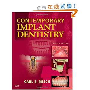 Contemporary Implant Dentistry